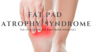 Fat Pads Atrophy Syndrome | Well Heeled Podiatry In Hampton