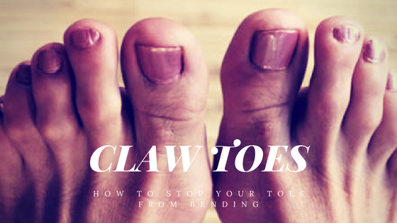 Claw Toes  Well Heeled Podiatry Hampton, Melbourne