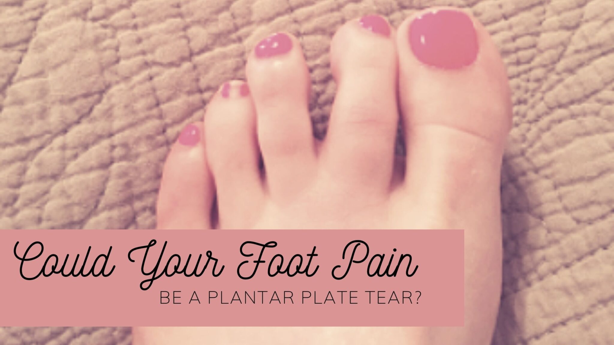 plantar-plate-tear-causing-pain-under-the-ball-of-your-foot-well