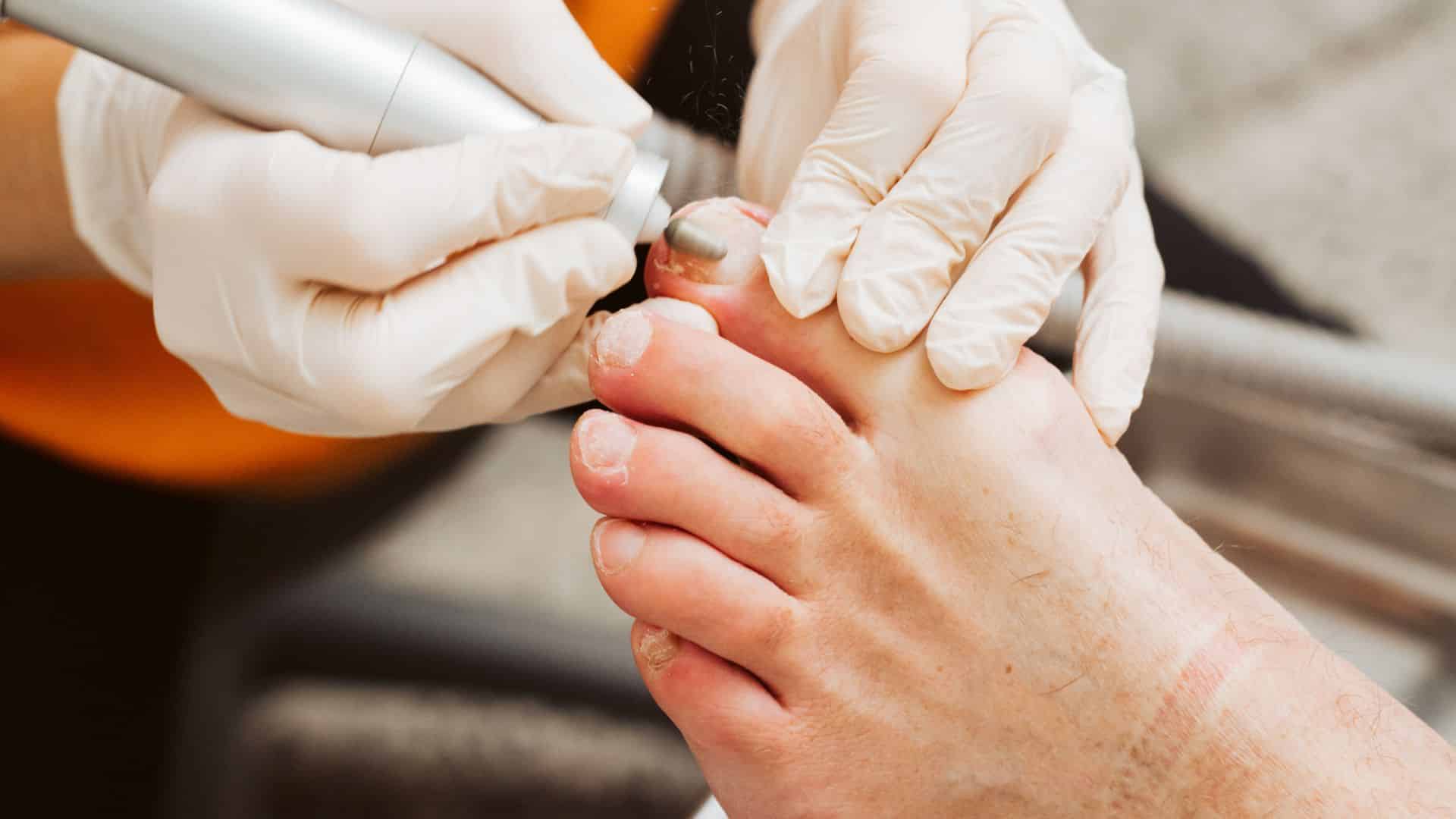 Nail Foot Care  Well Heeled Podiatry Hampton, Melbourne
